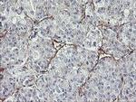 MIER2 Antibody in Immunohistochemistry (Paraffin) (IHC (P))