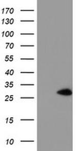 NANP Antibody in Western Blot (WB)