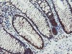 PPAT Antibody in Immunohistochemistry (Paraffin) (IHC (P))