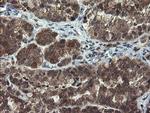 MLF1 Antibody in Immunohistochemistry (Paraffin) (IHC (P))