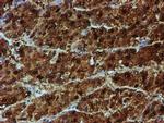 NQO2 Antibody in Immunohistochemistry (Paraffin) (IHC (P))