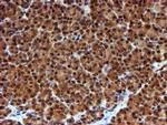 NQO2 Antibody in Immunohistochemistry (Paraffin) (IHC (P))