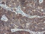 VBP1 Antibody in Immunohistochemistry (Paraffin) (IHC (P))