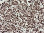 CHN1 Antibody in Immunohistochemistry (Paraffin) (IHC (P))