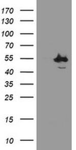 CHN1 Antibody in Western Blot (WB)