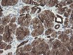 SLA2 Antibody in Immunohistochemistry (Paraffin) (IHC (P))