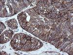 RIOK2 Antibody in Immunohistochemistry (Paraffin) (IHC (P))