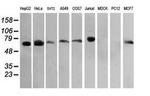 RIOK2 Antibody in Western Blot (WB)