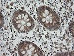 MRPS34 Antibody in Immunohistochemistry (Paraffin) (IHC (P))