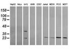 RAB30 Antibody in Western Blot (WB)