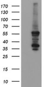 CESK1 Antibody in Western Blot (WB)