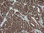 RAB30 Antibody in Immunohistochemistry (Paraffin) (IHC (P))