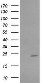 RAB30 Antibody in Western Blot (WB)