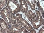 TRAPPC4 Antibody in Immunohistochemistry (Paraffin) (IHC (P))