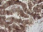 RhoJ Antibody in Immunohistochemistry (Paraffin) (IHC (P))