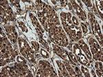 RhoJ Antibody in Immunohistochemistry (Paraffin) (IHC (P))