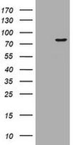 POGK Antibody in Western Blot (WB)