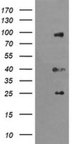 USP16 Antibody in Western Blot (WB)