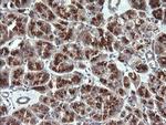 VTI1A Antibody in Immunohistochemistry (Paraffin) (IHC (P))