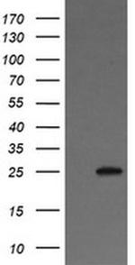 VTI1A Antibody in Western Blot (WB)