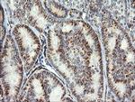 COPS6 Antibody in Immunohistochemistry (Paraffin) (IHC (P))