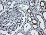 DNM1L Antibody in Immunohistochemistry (Paraffin) (IHC (P))