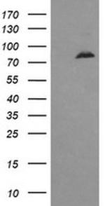 DNM1L Antibody in Western Blot (WB)