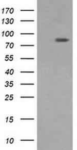 DNM1L Antibody in Western Blot (WB)