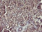 Arginase 2 Antibody in Immunohistochemistry (Paraffin) (IHC (P))