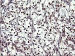 UPRT Antibody in Immunohistochemistry (Paraffin) (IHC (P))