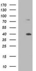 UPRT Antibody in Western Blot (WB)