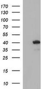 HAUS7 Antibody in Western Blot (WB)