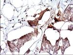 SPHK1 Antibody in Immunohistochemistry (Paraffin) (IHC (P))