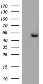 SPHK1 Antibody in Western Blot (WB)