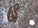 CNOT4 Antibody in Immunohistochemistry (Paraffin) (IHC (P))