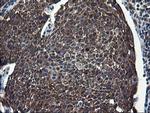 CNOT4 Antibody in Immunohistochemistry (Paraffin) (IHC (P))