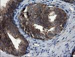 CNOT4 Antibody in Immunohistochemistry (Paraffin) (IHC (P))