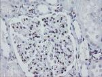 MEIS3 Antibody in Immunohistochemistry (Paraffin) (IHC (P))