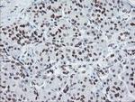 MEIS3 Antibody in Immunohistochemistry (Paraffin) (IHC (P))