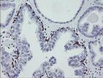 MEIS3 Antibody in Immunohistochemistry (Paraffin) (IHC (P))