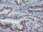 MEIS3 Antibody in Immunohistochemistry (Paraffin) (IHC (P))