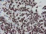 MEIS3 Antibody in Immunohistochemistry (Paraffin) (IHC (P))