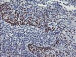 MEIS3 Antibody in Immunohistochemistry (Paraffin) (IHC (P))