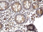 ARL2BP Antibody in Immunohistochemistry (Paraffin) (IHC (P))