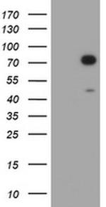 HIF3A Antibody in Western Blot (WB)