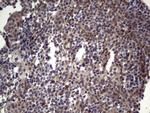 TET1 Antibody in Immunohistochemistry (Paraffin) (IHC (P))