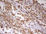 DDX56 Antibody in Immunohistochemistry (Paraffin) (IHC (P))