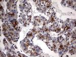 CK1 gamma-2 Antibody in Immunohistochemistry (Paraffin) (IHC (P))