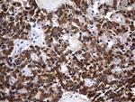 CK1 gamma-2 Antibody in Immunohistochemistry (Paraffin) (IHC (P))