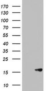 AVPI1 Antibody in Western Blot (WB)